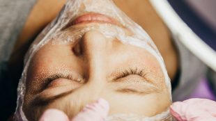 cosmetologist performs laser rejuvenation procedure. Close-up. CO2 Fractional Laser. CO2 laser resurfacing article on Title Sussex Magazine - www.titlesussex.co.uk