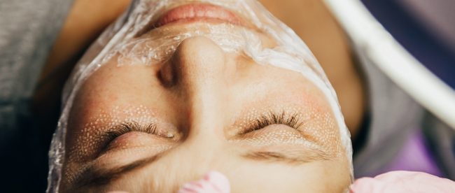CO2 laser resurfacing article on Title Sussex Magazine - www.titlesussex.co.uk cosmetologist performs laser rejuvenation procedure. Close-up. CO2 Fractional Laser. CO2 laser resurfacing article on Title Sussex Magazine - www.titlesussex.co.uk